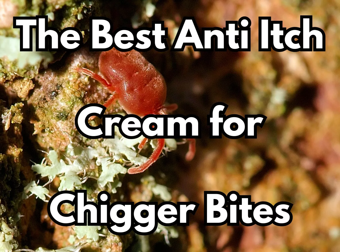 The Best Anti Itch Cream for Chigger Bites